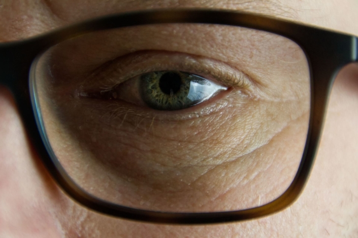 Auge-Krankheiten mit Auswirkungen auf die Augen-Herpes-Header-Bild