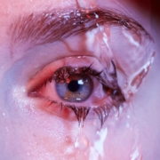 Auge-Augenkrankheiten-brennendeAugen-Header-Bild