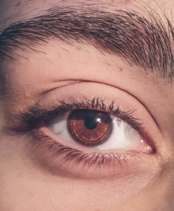 Auge-Augenkrankheiten-Augenlidzucken-Header-Bild
